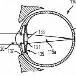 google-files-patent-application-for-intraocular-smart-lens.png